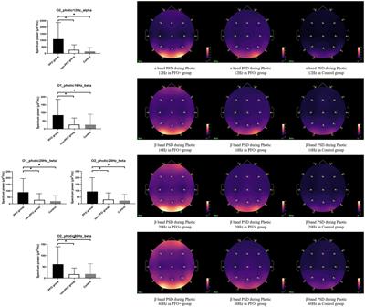 The patent foramen ovale may alter migraine brain activity: A pilot study of electroencephalography spectrum and functional connectivity analysis